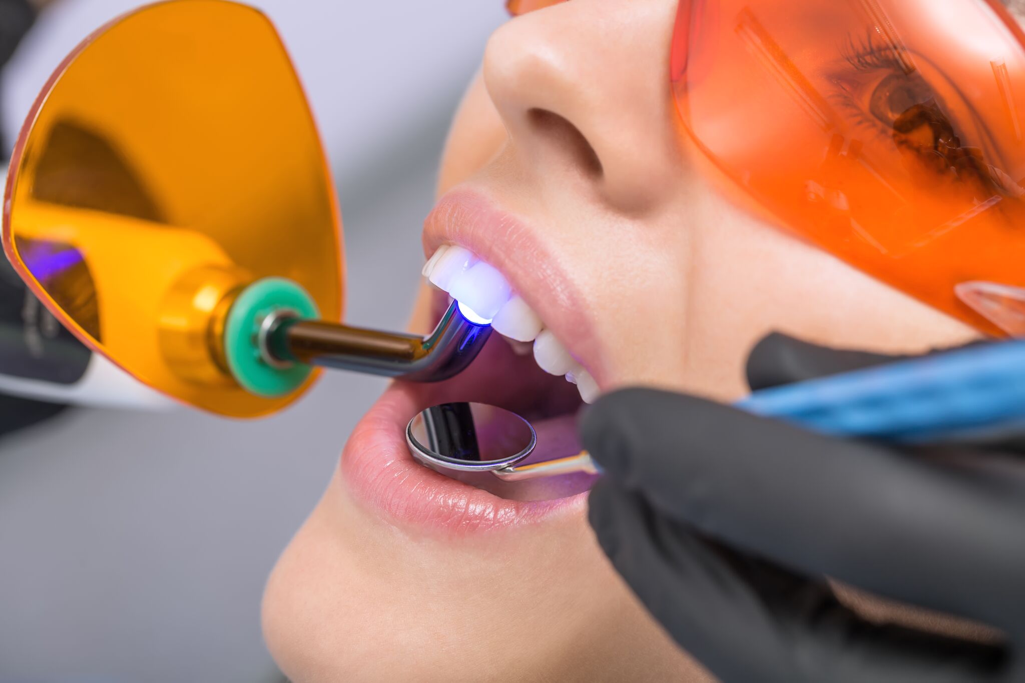 Your Guide to Laser Dentistry